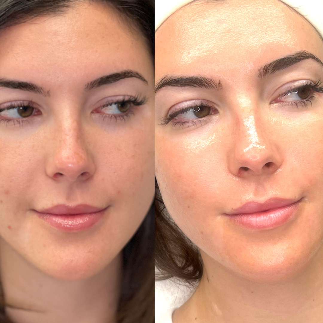 Before skin transformation