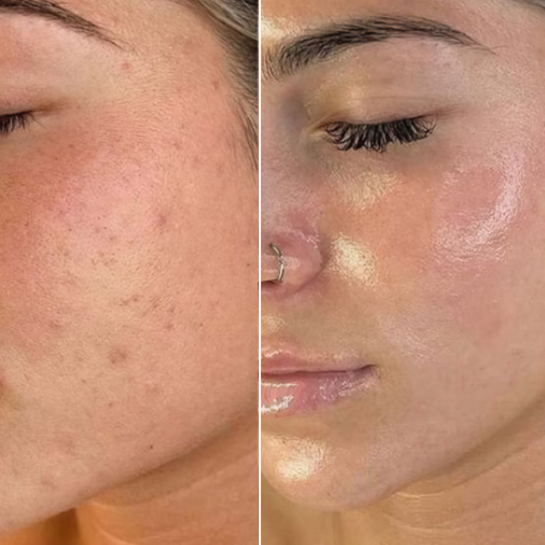 Before skin transformation