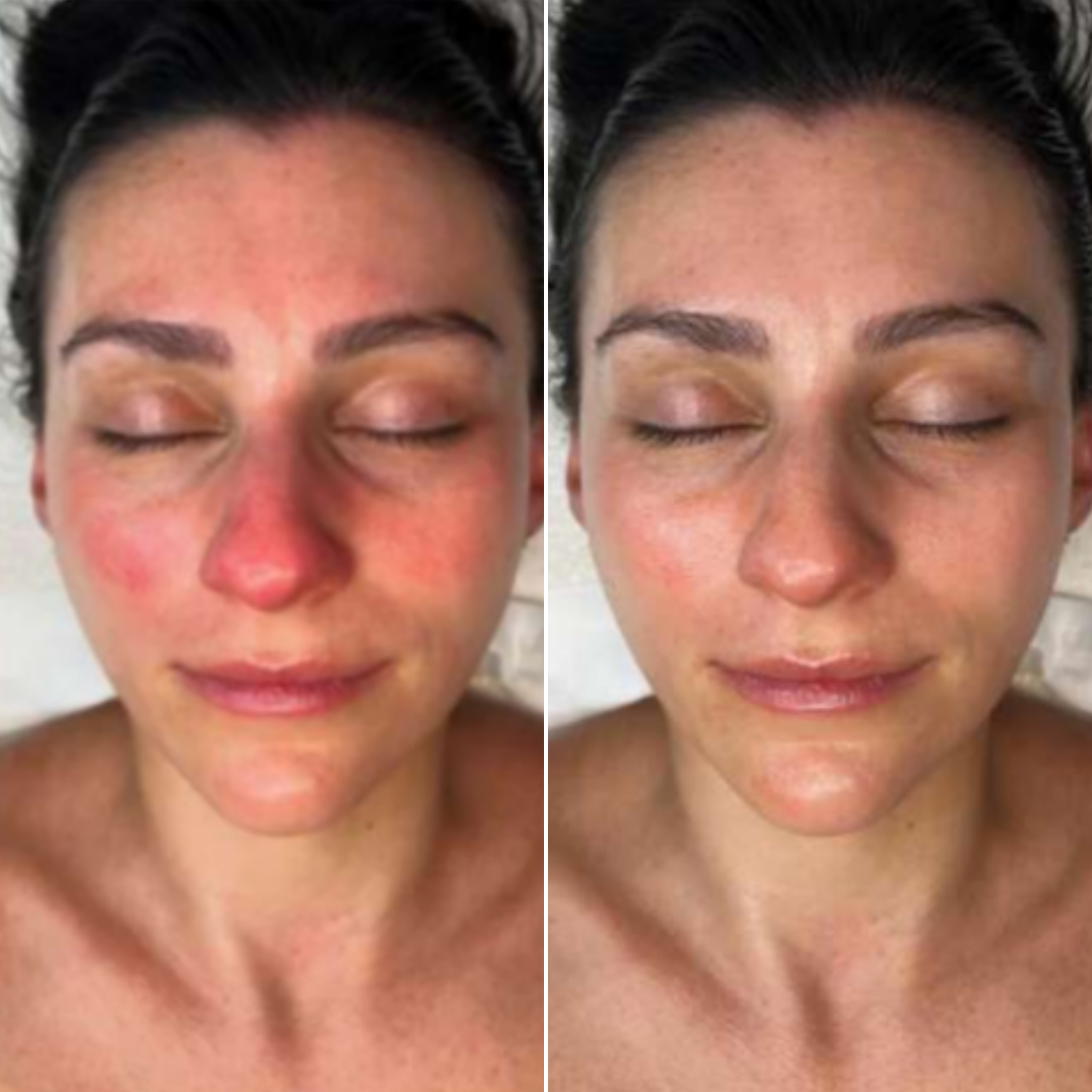 Before skin transformation